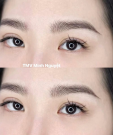 Thẩm Mỹ Viện Minh Nguyệt