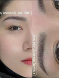 Thẩm Mỹ Viện Minh Nguyệt