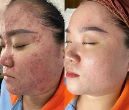 Thẩm Mỹ Viện Minh Nguyệt