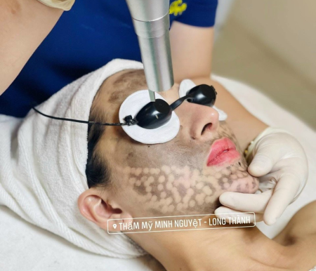 Thẩm Mỹ Viện Minh Nguyệt