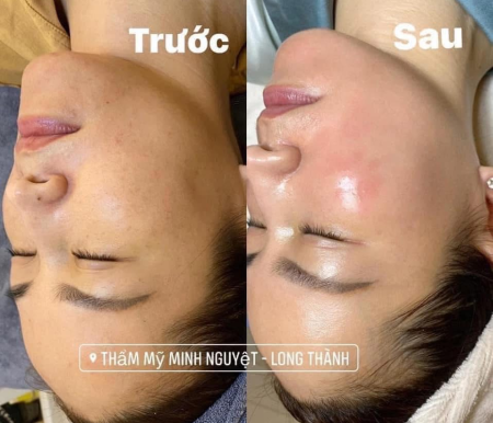 Thẩm Mỹ Viện Minh Nguyệt