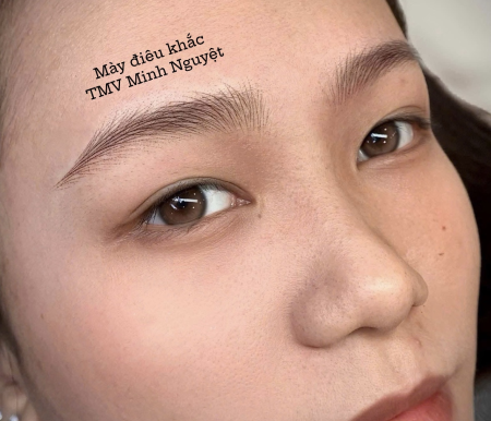 Thẩm Mỹ Viện Minh Nguyệt