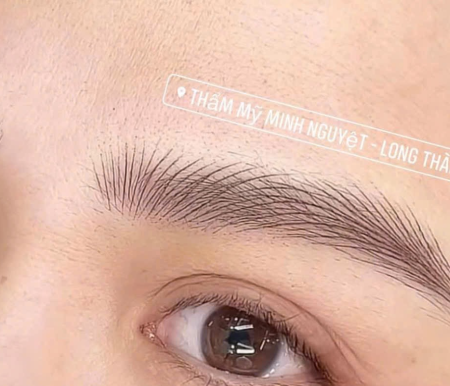 Thẩm Mỹ Viện Minh Nguyệt