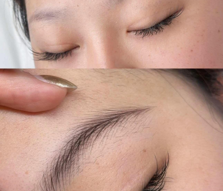 Thẩm Mỹ Viện Minh Nguyệt