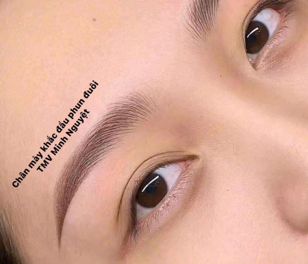Thẩm Mỹ Viện Minh Nguyệt