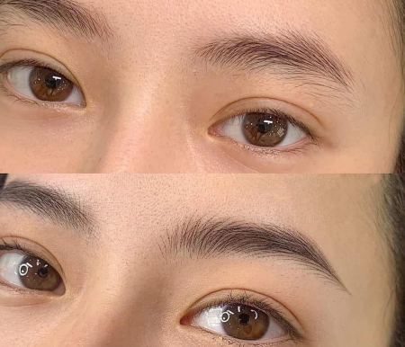 Thẩm Mỹ Viện Minh Nguyệt